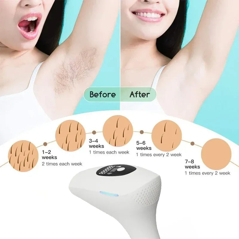 IPL Laser Hair Removal Machine SM-888 - Permanent Female Hairs Removing Pulsed Light Electric Depilatory Device For Facial